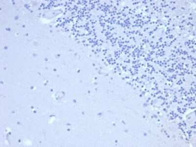 Immunohistochemistry-Paraffin: Prolactin Antibody (rPRL/4909) - Azide and BSA Free [NBP3-08245]