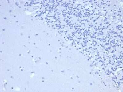 Immunohistochemistry-Paraffin: Prolactin Antibody (rPRL/4909) [NBP3-07240]