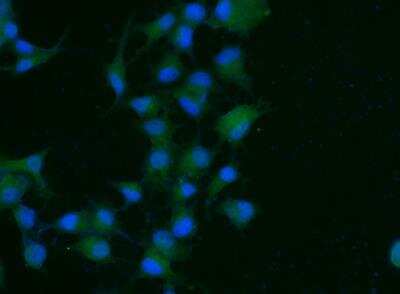 Immunocytochemistry/ Immunofluorescence: Prolactin R Antibody (204) [NBP2-89377]