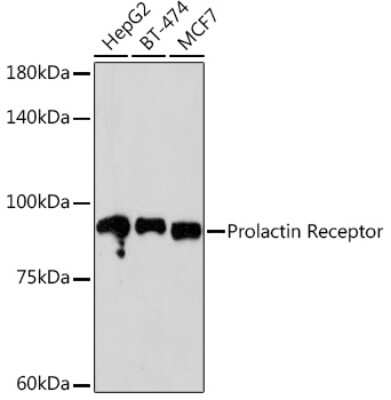 Western Blot: Prolactin R Antibody (9B10J3) [NBP3-16336]