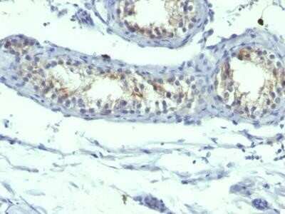 Immunohistochemistry-Paraffin: Prolactin R Antibody (B6.2 + PRLR742) - Azide and BSA Free [NBP2-34555]