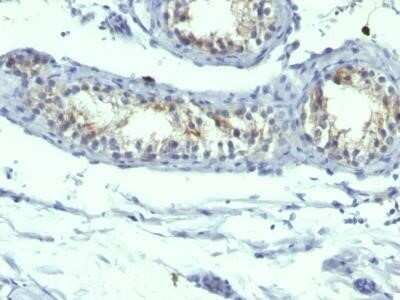 Immunohistochemistry-Paraffin: Prolactin R Antibody (B6.2 + PRLR742) - IHC-Prediluted [NBP2-44626]