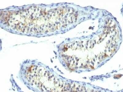 Immunohistochemistry-Paraffin: Prolactin R Antibody (B6.2) - Azide and BSA Free [NBP2-34554]