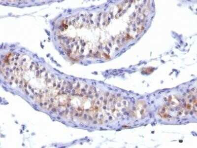 Immunohistochemistry-Paraffin: Prolactin R Antibody (PRLR/742) - Azide and BSA Free [NBP2-34712]