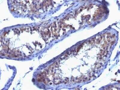 Immunohistochemistry-Paraffin: Prolactin R Antibody (SPM213) - Azide and BSA Free [NBP2-34746]