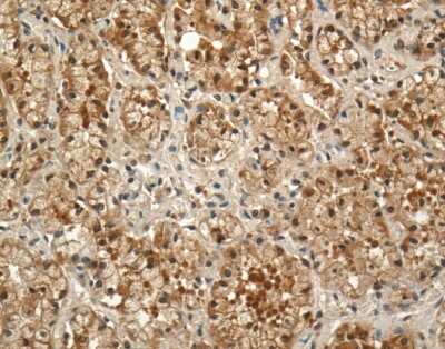 Immunohistochemistry: Prolactin R Antibody (U5) [NB300-561]