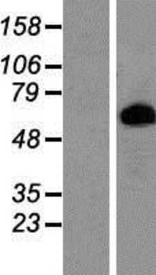 Western Blot: Prolactin R Overexpression Lysate [NBP2-10720]