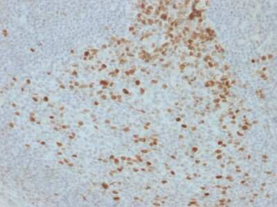 Immunohistochemistry-Paraffin: Proliferation Marker Antibody (JC1) - Azide and BSA Free [NBP3-08342]