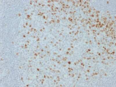 Immunohistochemistry-Paraffin: Proliferation Marker Antibody (JC1) - Azide and BSA Free [NBP3-08342]