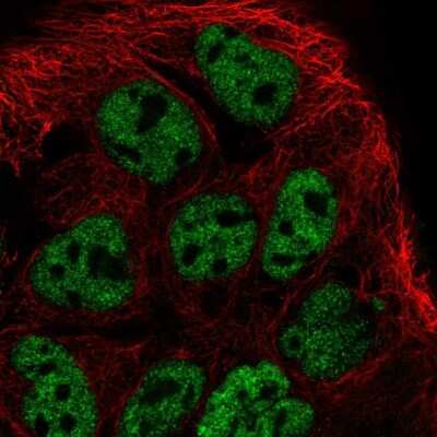 Immunocytochemistry/ Immunofluorescence: Proline-Rich Basic Protein 1 Antibody [NBP2-49310]