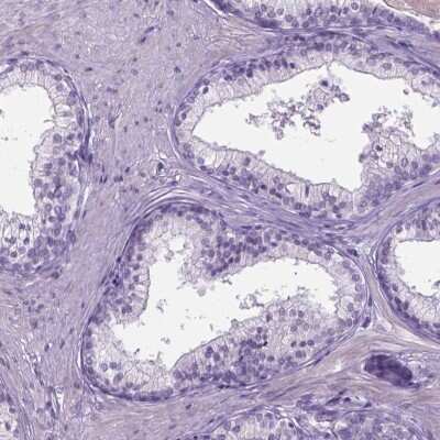 Immunohistochemistry-Paraffin: Proline-Rich Basic Protein 1 Antibody [NBP2-49310]