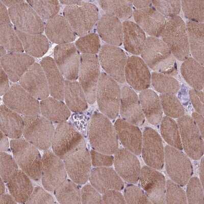 Immunohistochemistry-Paraffin: Proline-Rich Basic Protein 1 Antibody [NBP2-49310]