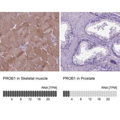 Immunohistochemistry-Paraffin: Proline-Rich Basic Protein 1 Antibody [NBP2-49310]