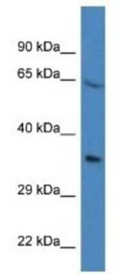 Western Blot: Proline rich 16 Antibody [NBP1-79655]