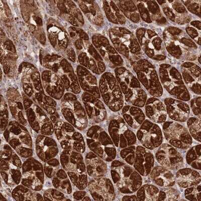 Immunohistochemistry: Prolyl Oligopeptidase/PREP Antibody [NBP2-32014]