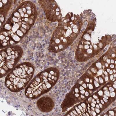 Immunohistochemistry: Prolyl Oligopeptidase/PREP Antibody [NBP2-32015]