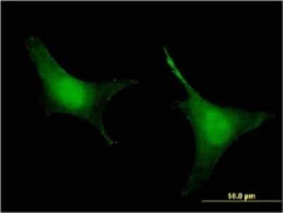 Immunocytochemistry/ Immunofluorescence: Prolyl Oligopeptidase/PREP Antibody (2D7) [H00005550-M04]