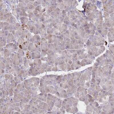 Immunohistochemistry-Paraffin: Prolyl Oligopeptidase/PREP Antibody [NBP2-33950]