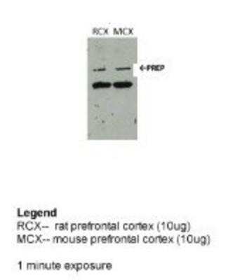 Western Blot: Prolyl Oligopeptidase/PREP Antibody [NBP1-56841]