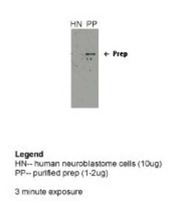 Western Blot: Prolyl Oligopeptidase/PREP Antibody [NBP1-56842]