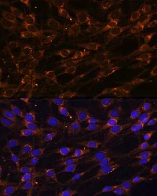 Immunocytochemistry/ Immunofluorescence: Prolyl endopeptidase-like Antibody - Azide and BSA Free [NBP2-93305]