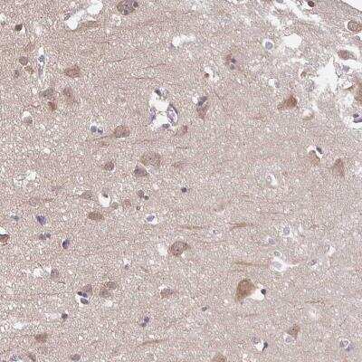 Immunohistochemistry-Paraffin: Prolyl endopeptidase-like Antibody [NBP2-31868]