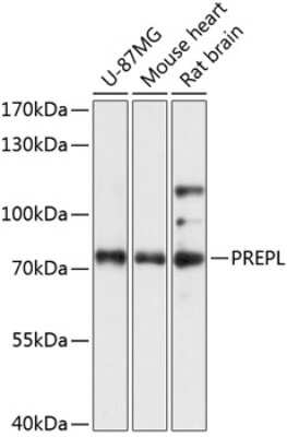 Western Blot: Prolyl endopeptidase-like AntibodyAzide and BSA Free [NBP2-93305]