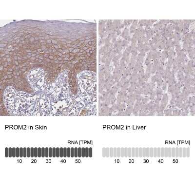 Immunohistochemistry-Paraffin: Prominin 2 Antibody [NBP2-38032]