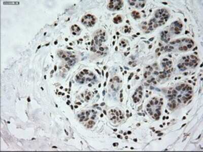 Immunohistochemistry: Prominin 2 Antibody (OTI6B7) - Azide and BSA Free [NBP2-73616]