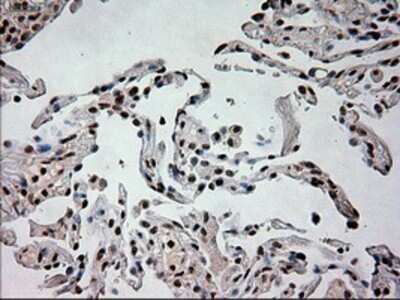 Immunohistochemistry: Prominin 2 Antibody (OTI6B7) - Azide and BSA Free [NBP2-73616]