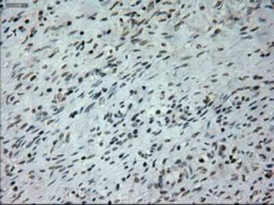 Immunohistochemistry: Prominin 2 Antibody (OTI6B7) - Azide and BSA Free [NBP2-73616]