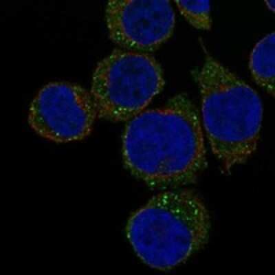 Immunocytochemistry/ Immunofluorescence: Properdin Antibody [NBP3-17755]