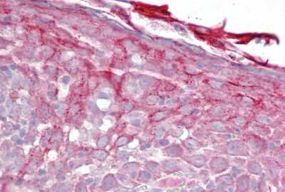 Immunohistochemistry-Paraffin: Properdin Antibody [NBP1-58974]