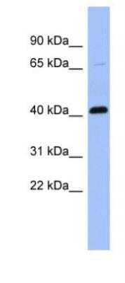 Western Blot: Properdin Antibody [NBP1-58974]