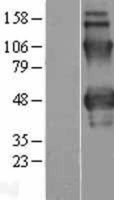 Western Blot: Properdin Overexpression Lysate [NBP2-11352]