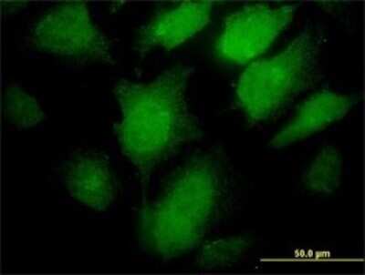 Immunocytochemistry/ Immunofluorescence: Proprotein Convertase 1/PCSK1 Antibody (3D2) [H00005122-M02]