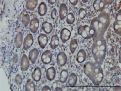Immunohistochemistry-Paraffin: Proprotein Convertase 1/PCSK1 Antibody (3D2) [H00005122-M02]
