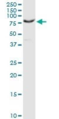 Western Blot: Proprotein Convertase 1/PCSK1 Antibody (3D2) [H00005122-M02]