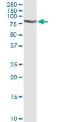 Western Blot: Proprotein Convertase 1/PCSK1 Antibody (3D2) [H00005122-M02]