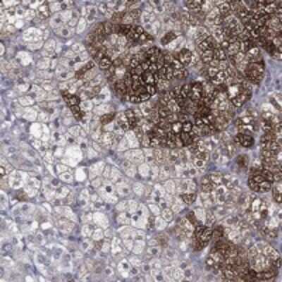 Immunohistochemistry-Paraffin: Proprotein Convertase 1/PCSK1 Antibody [NBP3-17642]