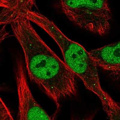 Immunocytochemistry/ Immunofluorescence: Proprotein Convertase 2/PCSK2 Antibody [NBP2-48942]