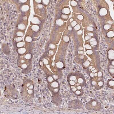 Immunohistochemistry: Proprotein Convertase 2/PCSK2 Antibody [NBP2-48942]