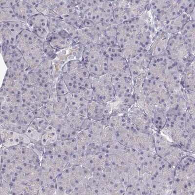 Immunohistochemistry-Paraffin: Proprotein Convertase 2/PCSK2 Antibody [NBP2-48942]