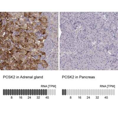 Immunohistochemistry-Paraffin: Proprotein Convertase 2/PCSK2 Antibody [NBP2-48942]