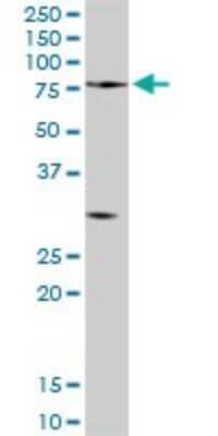 Western Blot: Proprotein Convertase 2/PCSK2 Antibody [H00005126-D01P]