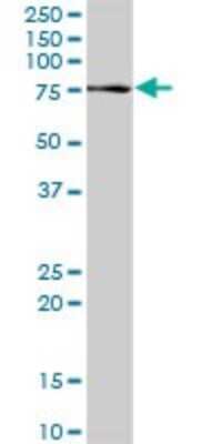 Western Blot: Proprotein Convertase 2/PCSK2 Antibody [H00005126-D01P]