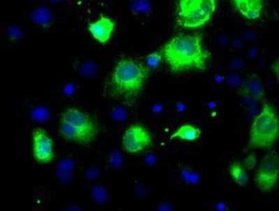 Immunocytochemistry/ Immunofluorescence: Proprotein Convertase 7/PCSK7 Antibody (OTI1B8) - Azide and BSA Free [NBP2-73621]