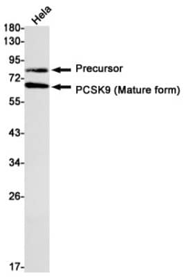 Western Blot: Proprotein Convertase 9/PCSK9 Antibody (S09-4F7) [NBP3-20047]