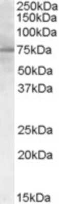 Western Blot: Proprotein Convertase 9/PCSK9 Antibody [NB300-959]