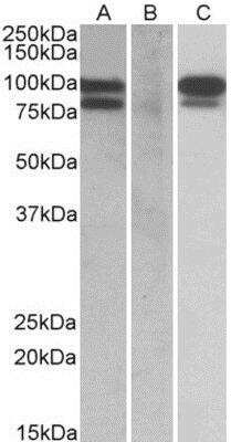 Western Blot: Proprotein Convertase 9/PCSK9 Antibody [NBP1-51923]